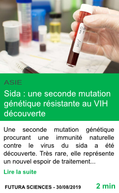 Science sida une seconde mutation genetique resistante au vih decouverte page001